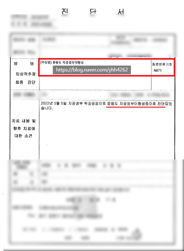 CIN2, N87.1지금도 제자리암 지급 가능한가요?