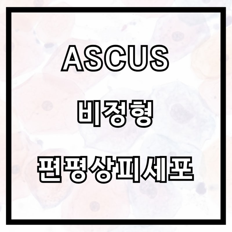 자궁경부암 검진 결과 ASCUS(비정형 편평상피세포)란?