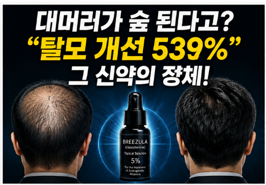 2026 브리줄라 탈모신약 539% 개선 진짜일까? 효과·부작용·출시일 총정리
