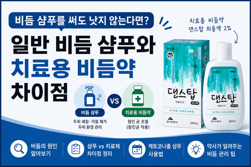 [치료용 비듬샴푸] 비듬 샴푸를 써도 낫지 않는다면? 치료용 비듬약(케토코나졸)의 차이점