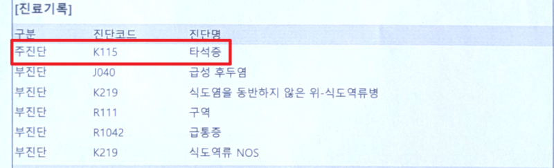 타석증 수술 후 신한생명 질병수술비 거절? 손해보험사는 주는데 왜 안 줄까? (수술분류표 완....