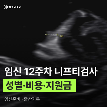 임신 12주차 니프티검사(NIPT) 후기 (성별 확인, 비용, 35세 이상 임산부 지원금 신청)