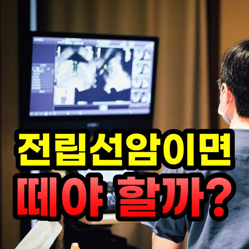 전립선암 진단 후 어떤 검사를 받을까요? 치료까지 진행 과정