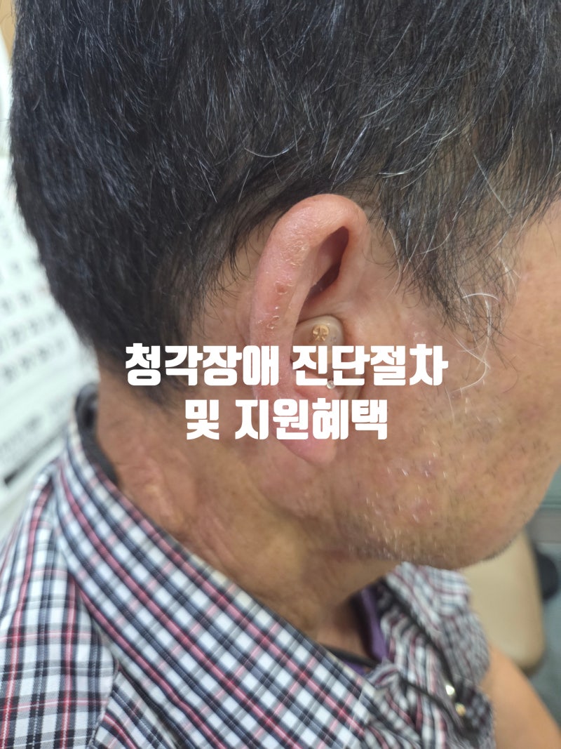 전주보청기 청각장애 진단 기준부터 검사, 등록 절차, 지원 제도까지 한 번에 알아보기!