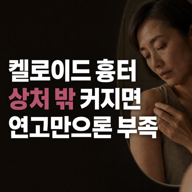 상처 밖으로 커진 켈로이드 흉터, 연고만 바르면 안 되는 이유