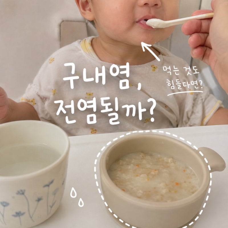 아기 구내염 전염될까? 증상부터 먹기 편한 음식까지