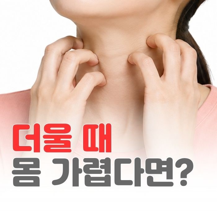 더울때 온몸이 가렵다면? 콜린성 두드러기 의심하세요