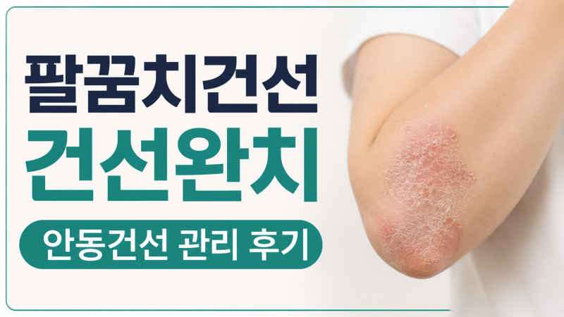 팔꿈치건선 건선완치 고민했던 안동건선 관리 후기 무료샘플부터 시작했어요