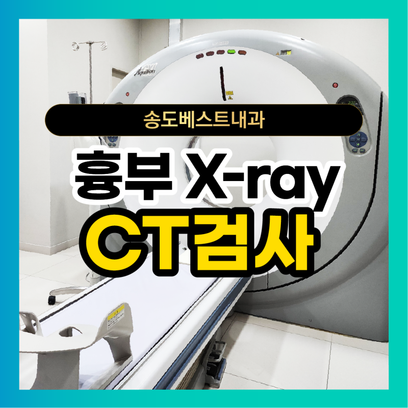 송도 흉부내과 X-ray로 확인이 어렵다면 흉부CT 검사