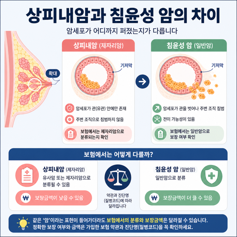 유방상피내암 진단, 일반적인 유방암과 무엇이 다를까?