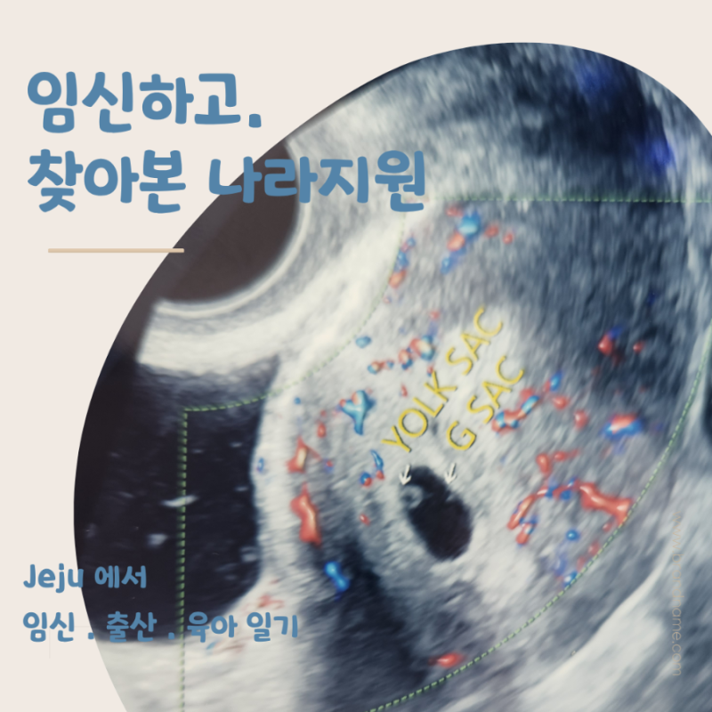 제주 임신 출산지원금 20가지 지원 총정리