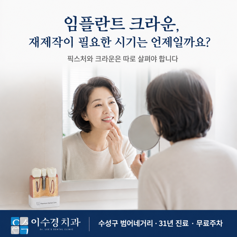 임플란트 크라운, 재제작이 필요한 시기는 언제일까요? | 수성구 치과 원장 직접 설명