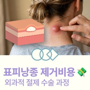 표피낭종 제거비용 및 재발 없는 외과적 절제술 수술 과정