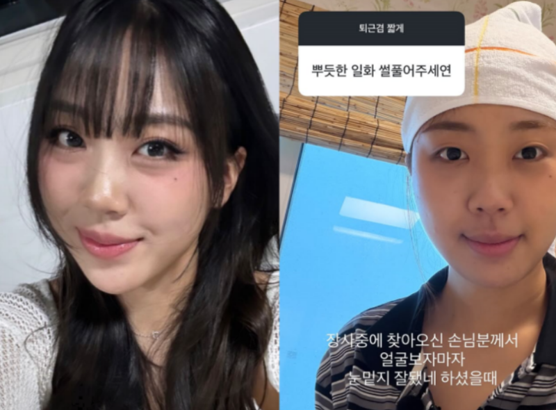 Lee Young-ji's Under-Eye Fat Repositioning: 4 Years of Deliberation, Finally Satisfied. The Reason I Looked Tired Even When I Wasn't