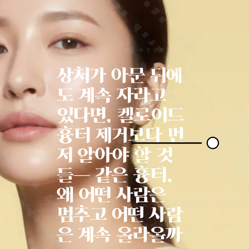상처가 아문 뒤에도 계속 자라고 있다면, 켈로이드 흉터 제거보다 먼저 알아야 할 것들— 같....