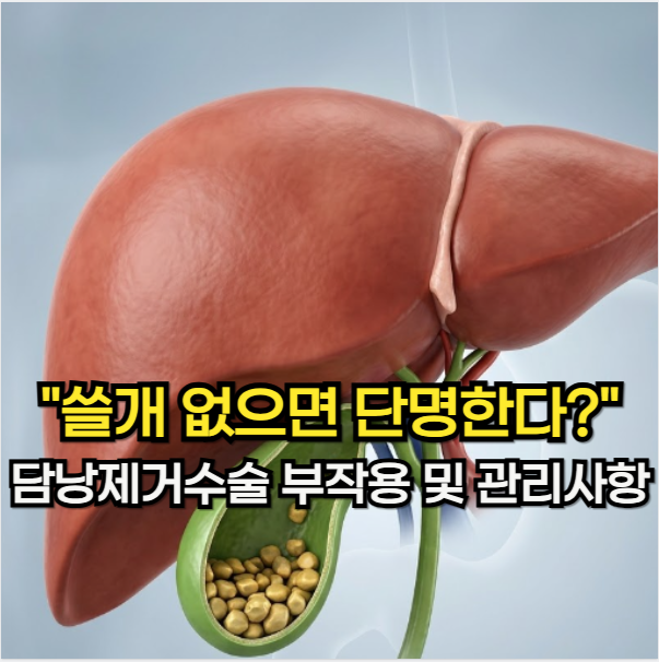 담낭 제거 수술, "쓸개 없으면 단명한다?" 담낭 제거 수술 부작용 및 관리법