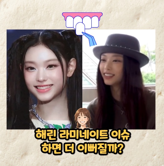 해린 라미네이트 이슈, 하면 더 이뻐질까?