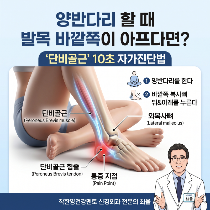 양반다리 할 때 발목 바깥쪽이 아프다면? '단비골근' 10초 자가진단법