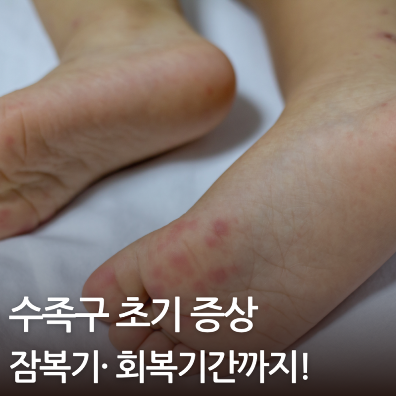 수족구 초기증상 순서 잠복기 회복기간 총정리