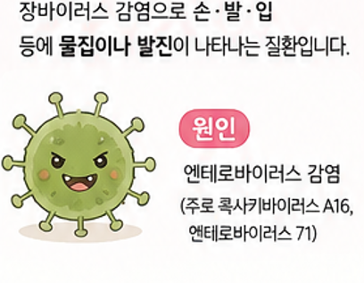 어린이 수족구병 초기증상과 후유증 총정리｜전염기간·잠복기·음식·어린이집 등원은 언제....