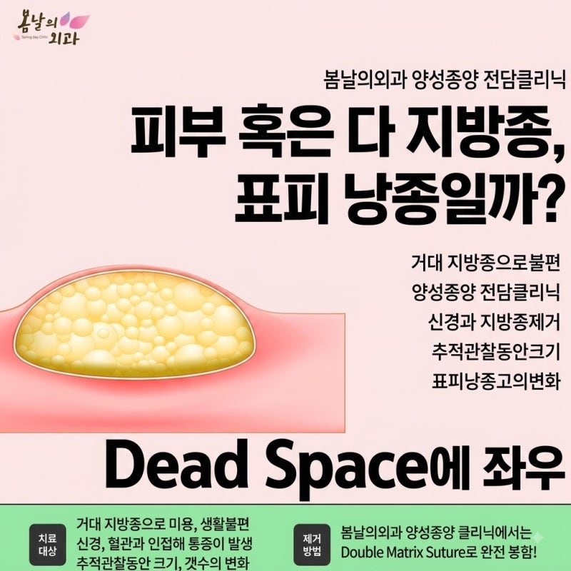 피부에 만져지는 혹은 다 지방종, 표피 낭종일까? Feat. 봄날의외과 (강서구, 양천구)