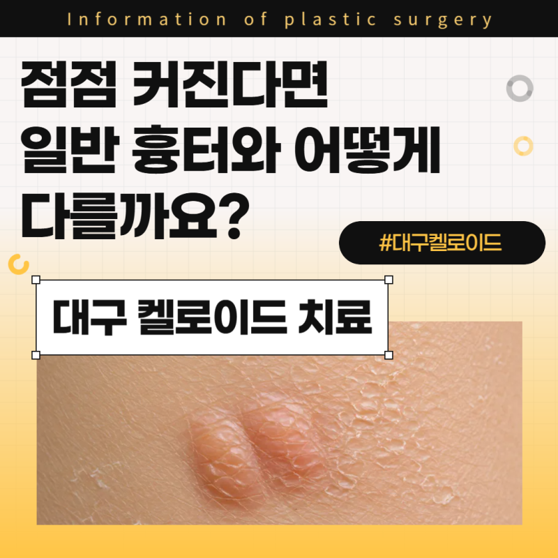 대구 켈로이드 치료, 점점 커진다면 일반 흉터와 어떻게 다를까요?