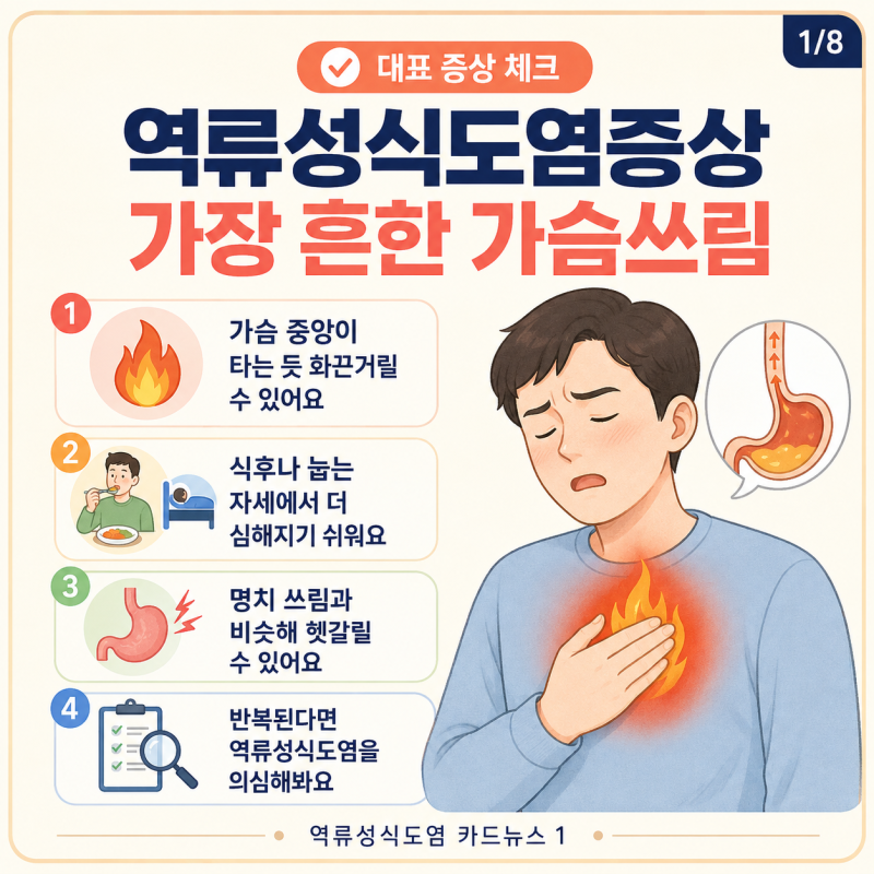 역류성식도염증상 명치 가슴 쓰림부터 기침 답답함 목 이물감까지 확인해야 할 변화