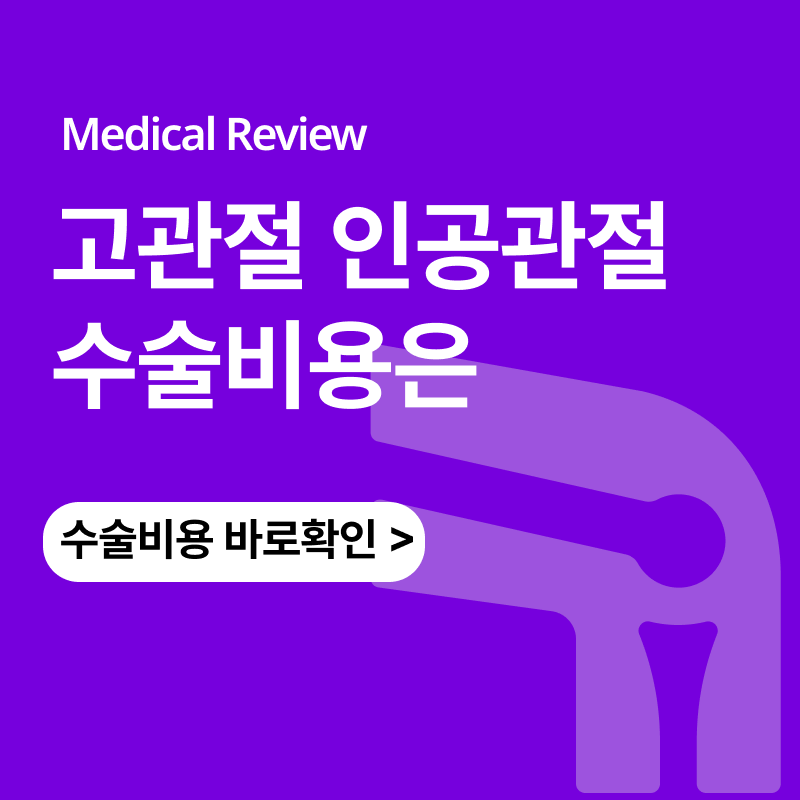고관절 인공관절수술 비용과 재수술 위험 수명은