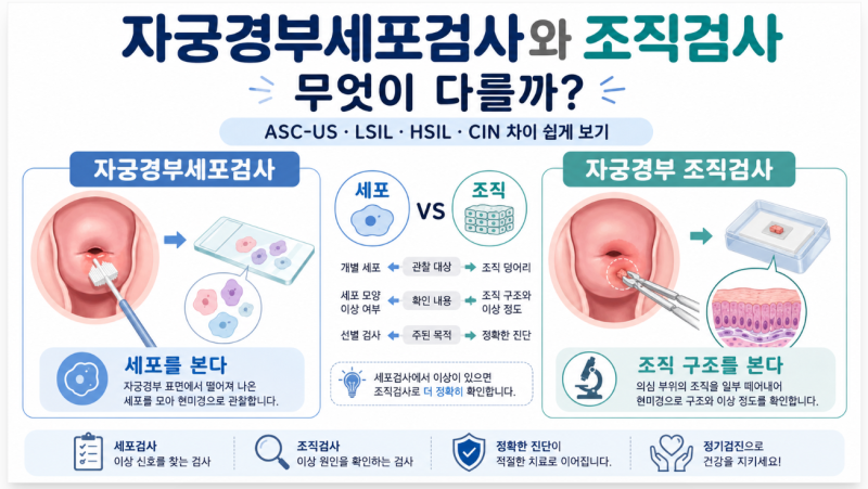 자궁경부세포검사와 조직검사는 무엇이 다를까? ASC-US·LSIL·CIN 차이