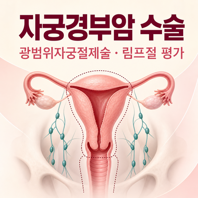 2026 자궁경부암 수술 총정리｜광범위자궁절제술·림프절절제술·부작용