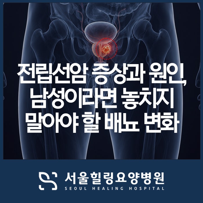 전립선암 증상과 전립선암 원인, 남성이라면 놓치지 말아야 할 배뇨 변화