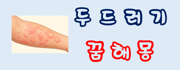 [두드러기꿈] 두드러기꿈해몽