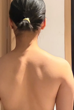 오른쪽 날개뼈 통증 왜 생기는지 정리
