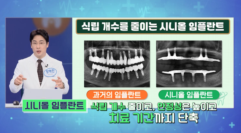 임플란트 수술 후 통증 언제까지? 기간별 회복 과정과 주의사항