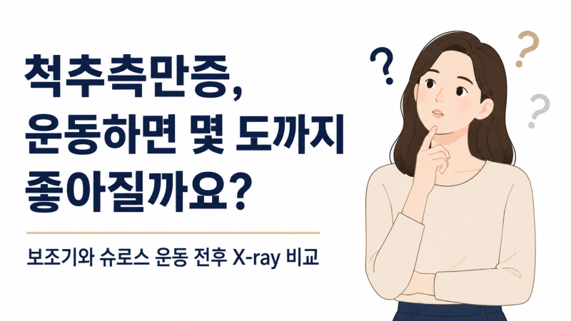 척추측만증, 운동하면 몇 도까지 좋아질까요?｜보조기와 슈로스 운동 전후 X-ray 비교
