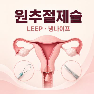 2026 자궁경부암 원추절제술 총정리｜LEEP·냉나이프·절제연·회복·임신