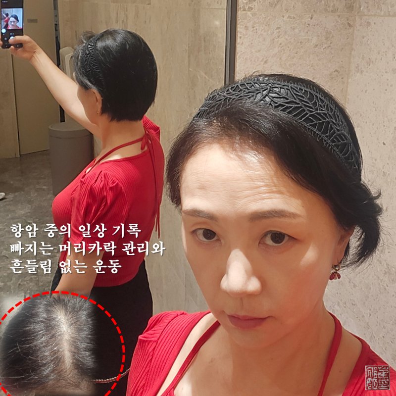 항암치료 부작용 극복 : 항암 탈모 관리 방법과 홈트레이닝 루틴