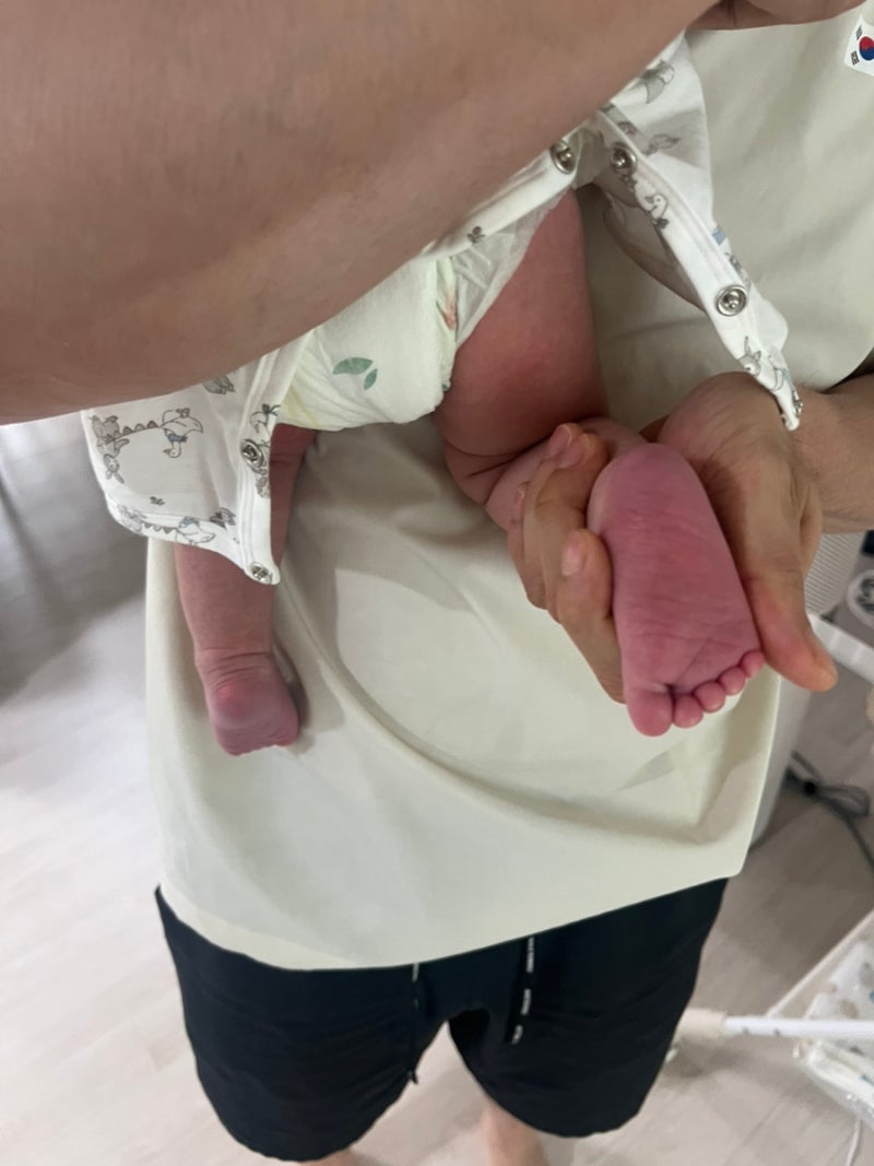 신생아 손발이 파래 보여요｜말단 청색증, 괜찮은 걸까요?