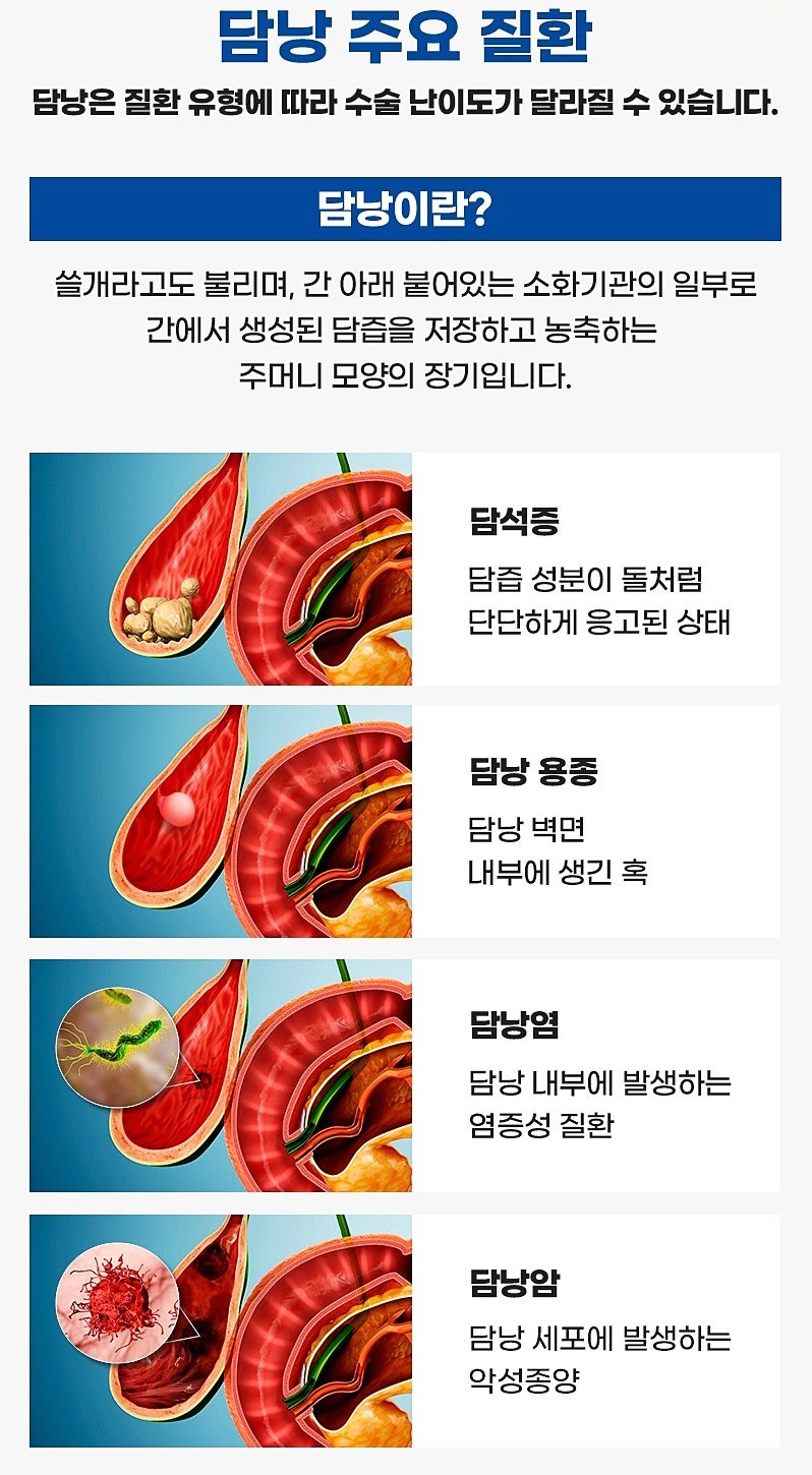 "쓸개가 없어도 사는 데 지장 없나요?" 담낭제거수술 후 정말 소화제 달고 살아야 할까?