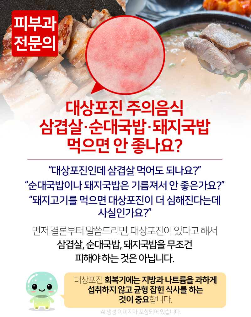 진주 대상포진 / 대상포진 주의음식, 삼겹살·순대국밥·돼지국밥 먹으면 안 좋나요?