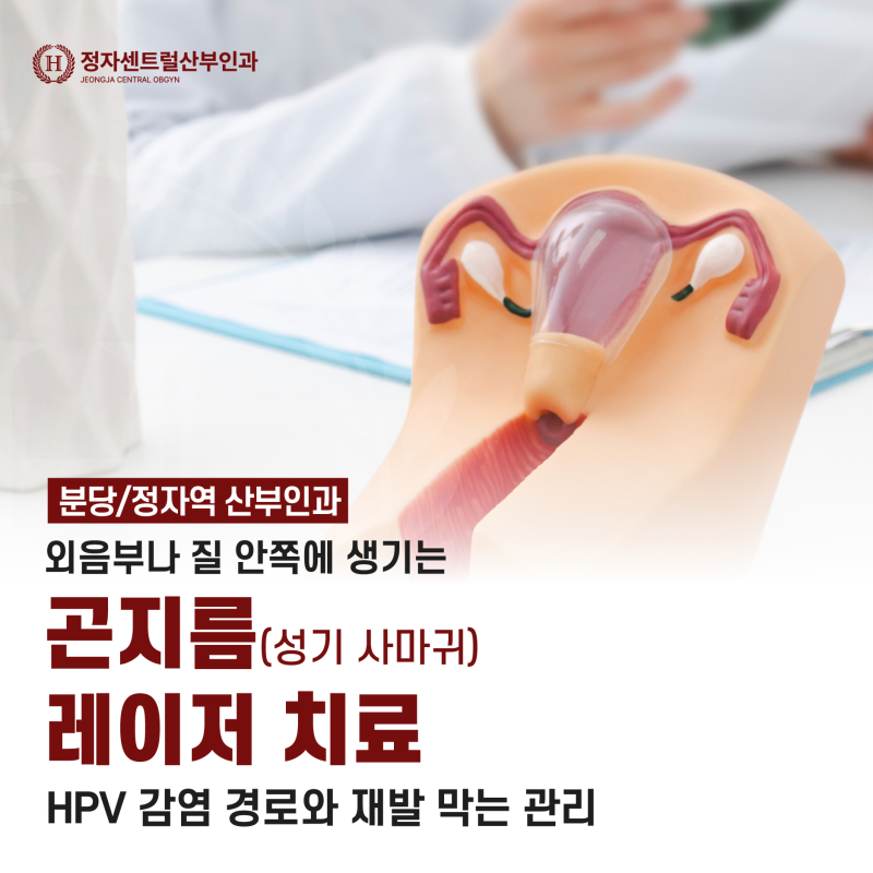 [분당/정자역 산부인과] 외음부나 질 안쪽에 생기는 곤지름(성기 사마귀) 레이저 치료, HPV 감....