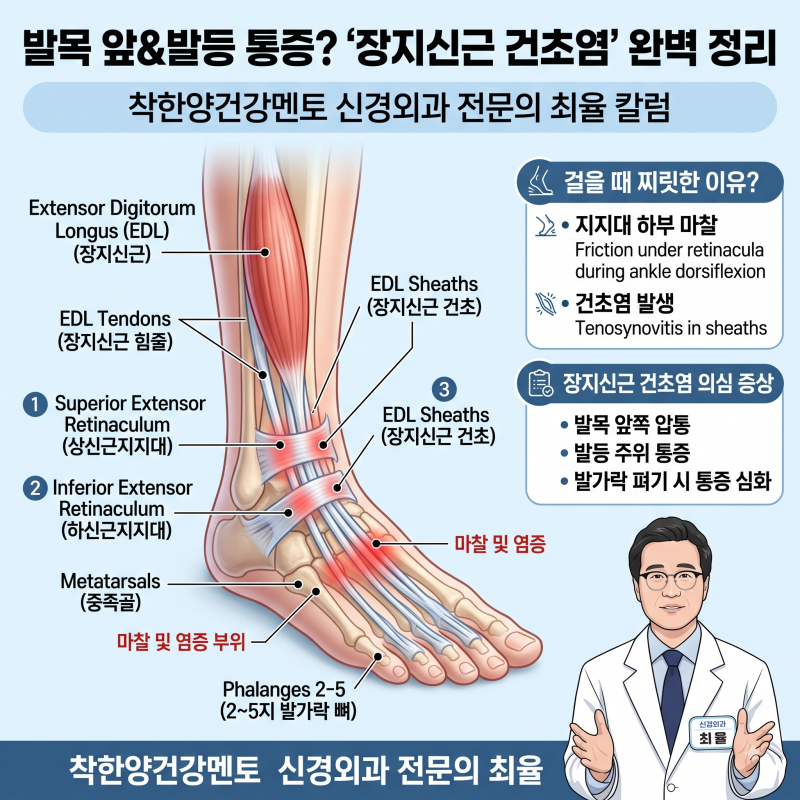 걸을 때마다 발목 앞쪽과 발등이 찌릿? 낫지 않는 통증의 주범 '장지신근 건초염' 완벽 가이....