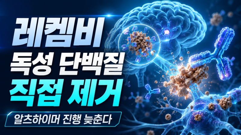레켐비 vs 키순라, 알츠하이머 신약 무엇이 다를까