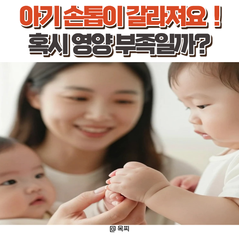 아기 손톱이 갈라지는 이유, 영양 부족일까? 관리법 총정리