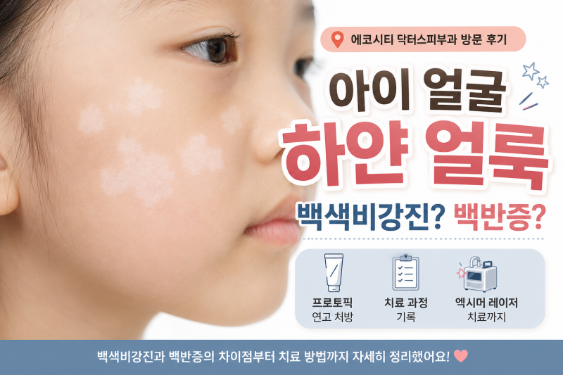 아이 얼굴 하얀 반점, 백색비강진 vs 백반증 차이｜에코시티 닥터스피부과 진료 후기