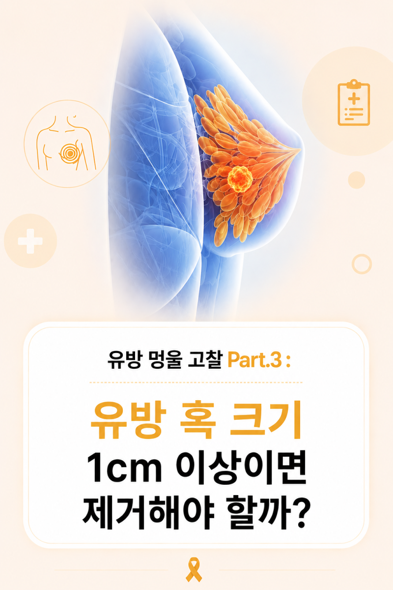 유방 멍울 고찰 Part. 3 : 유방 혹 크기 1cm 이상이면 제거해야 할까?