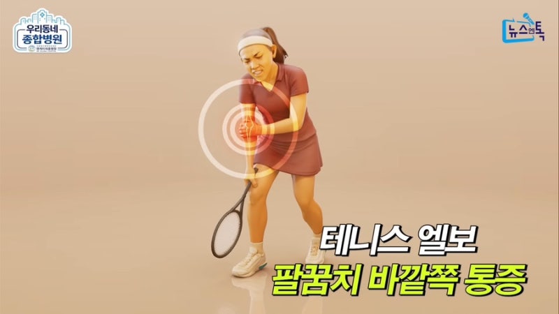 운동 안 해도 생기는 테니스 엘보·골프 엘보, 원인부터 치료까지