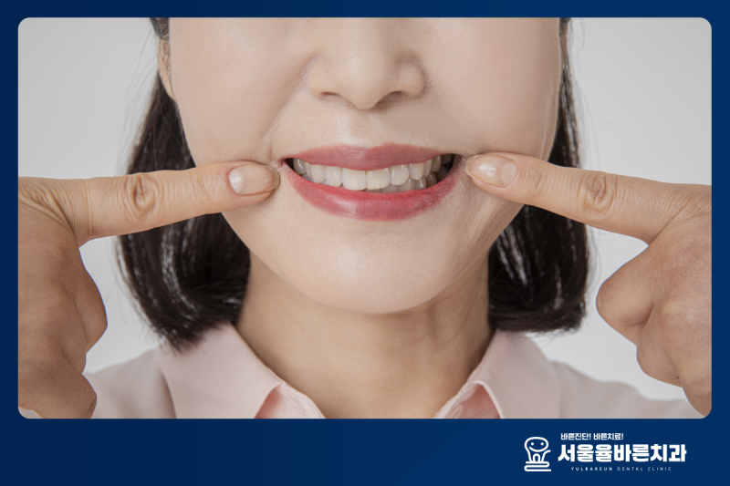 치아패임 잇몸내려감 원인에 따른 치료 방법