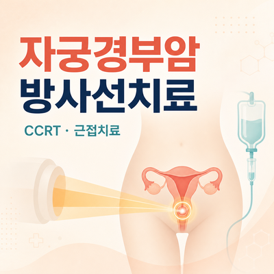 2026 자궁경부암 방사선치료 총정리｜CCRT·근접치료·질확장기