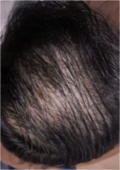보타랩샴푸 두 달 쓰고 놀란 얘기, 베개가 진짜 달라졌음